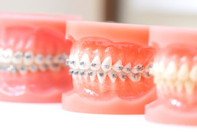 歯並びを悪くする原因まで掘り下げて治療します