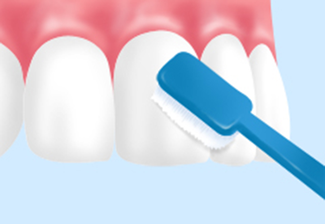ブラッシング指導
