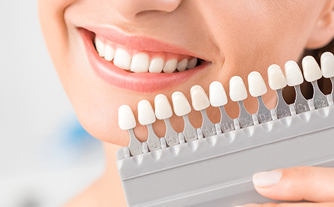 最適な素材と技術で自然な見た目と機能性を実現する審美治療