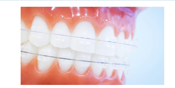 患者さま一人ひとりの希望に合わせた治療法をご提案しています