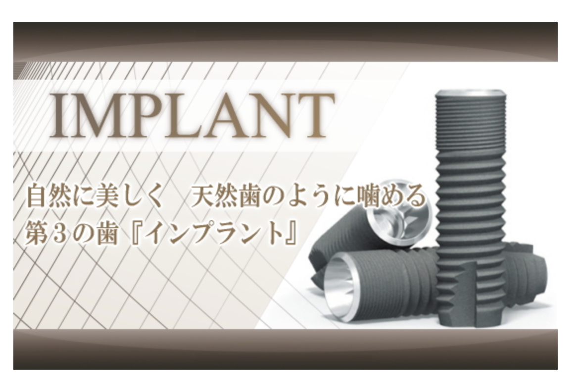 患者様の口腔状態や希望に応じて、1本から複数本のインプラントまで、幅広いケースに対応しています