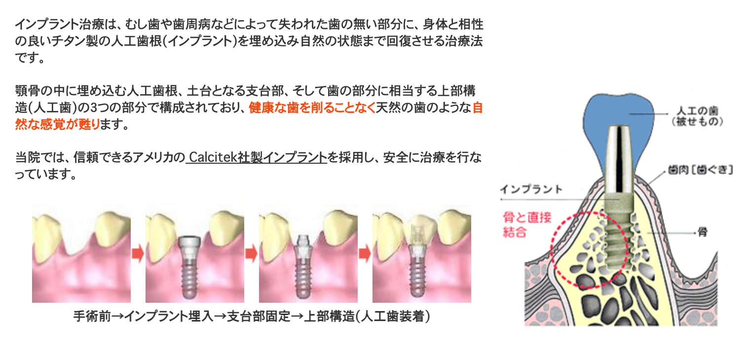 失われた歯の機能と見た目を回復する治療を提供しています