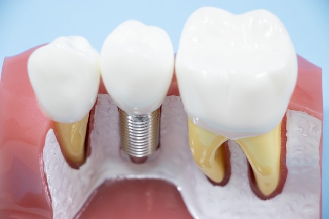 写真はイメージです