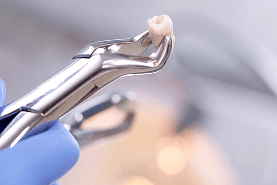 口腔外科では幅広い症状に対応しています