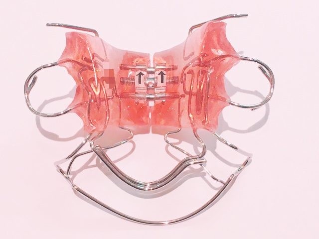 小さなお子様には床矯正を推奨しています