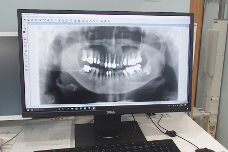 【西聖和駅 車15分】削らず残す治療と予防に力を入れる東川歯科クリニック
