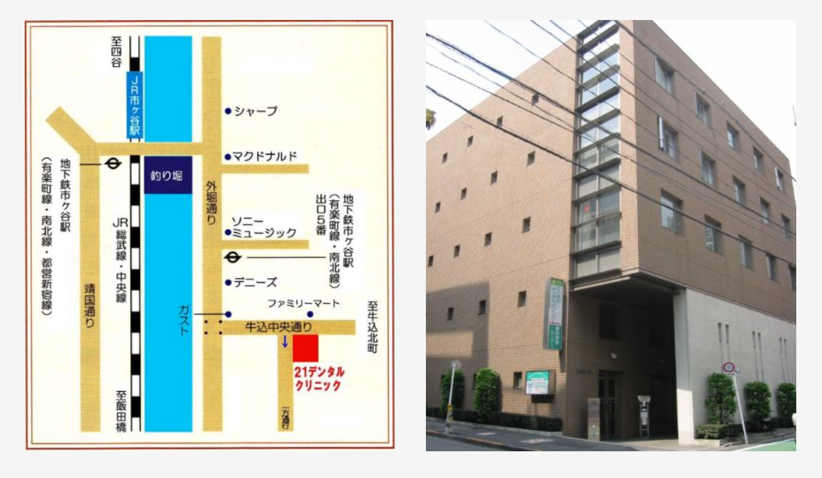 【市ヶ谷駅 徒歩2分】予防健診に特化した予約制の歯科医院 21デンタルクリニック