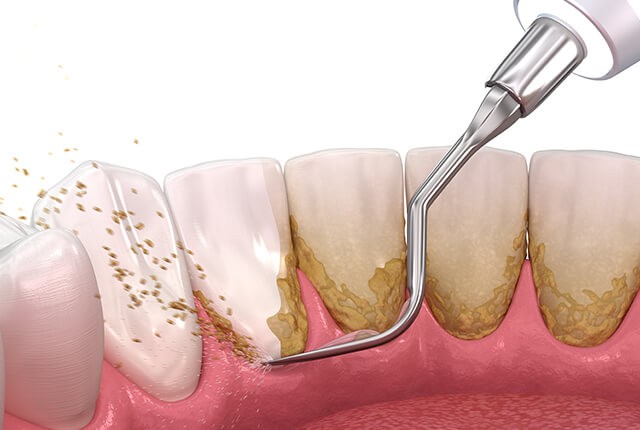 定期的なプロのメンテナンスを受けましょう