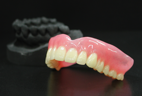 補綴歯科専門医による多様な義歯治療で咀嚼機能を的確に回復