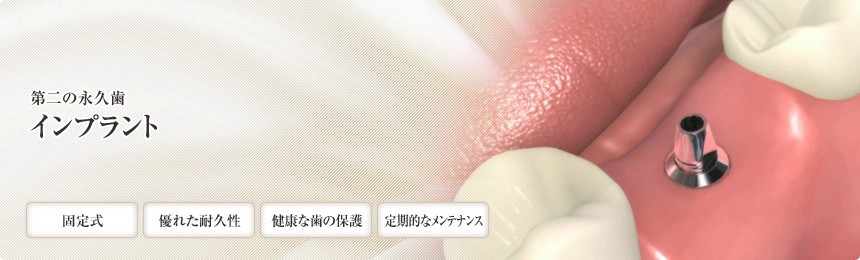 失った歯を補うインプラント治療