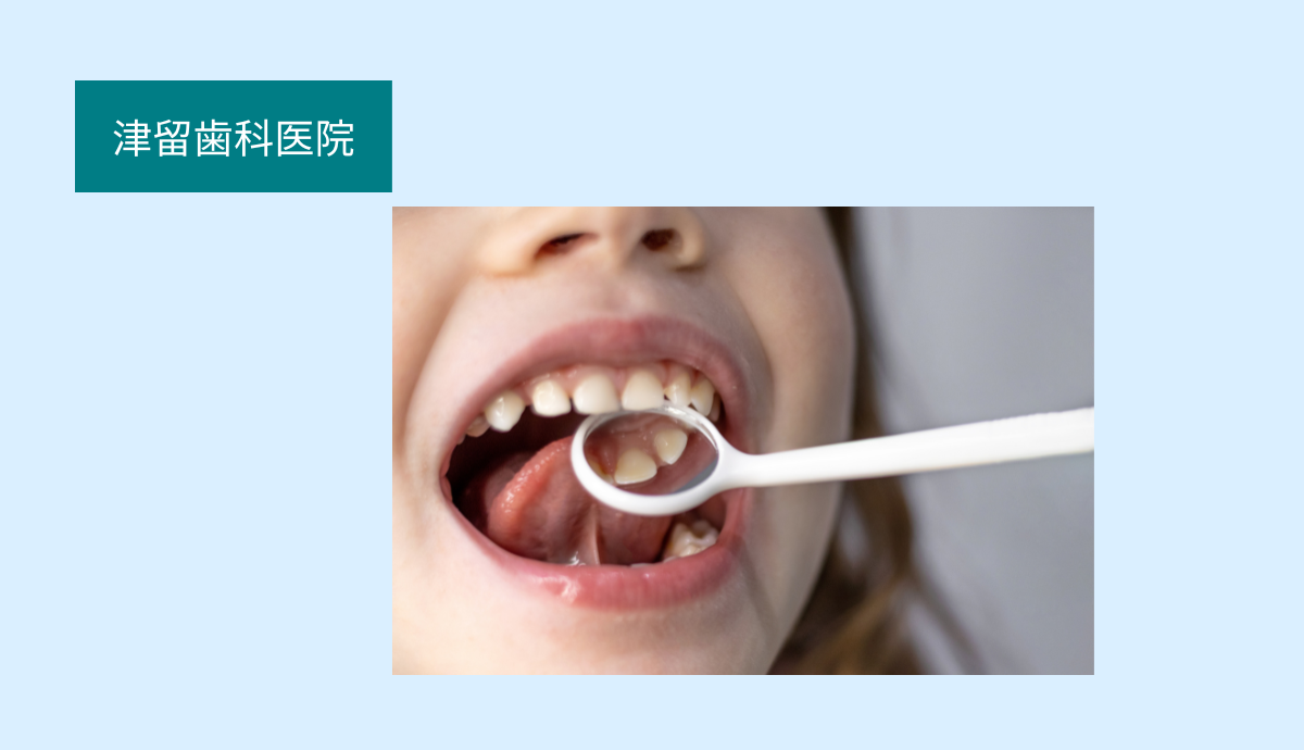 【痛みに配慮したむし歯治療と最小限の切削】