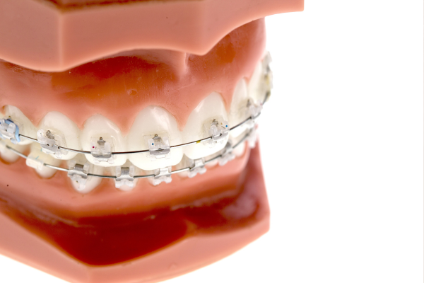 ※画像はイメージです