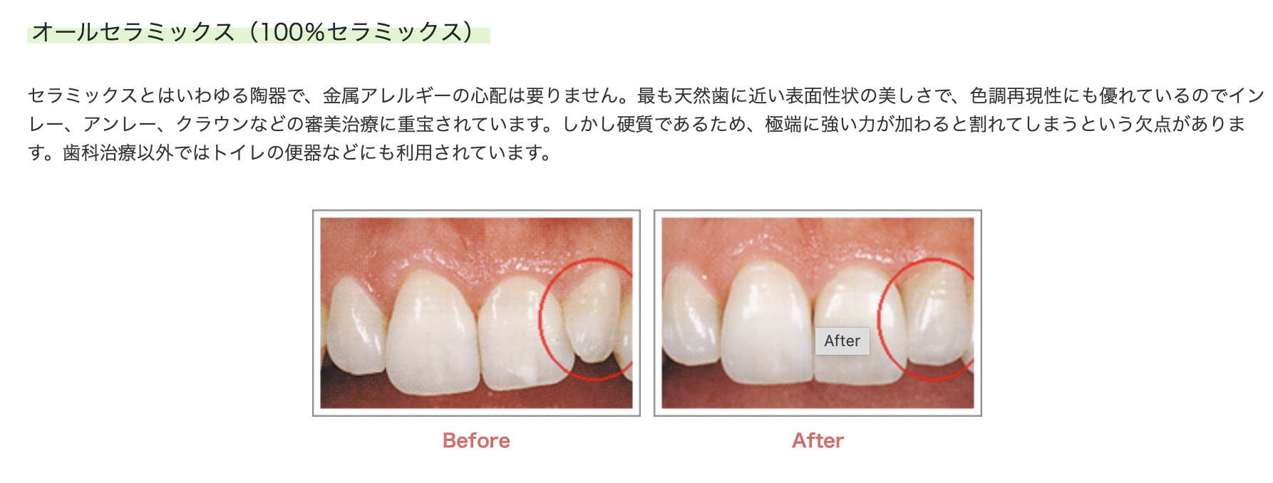 機能性と美しさを兼ね備えた審美治療を提供しています