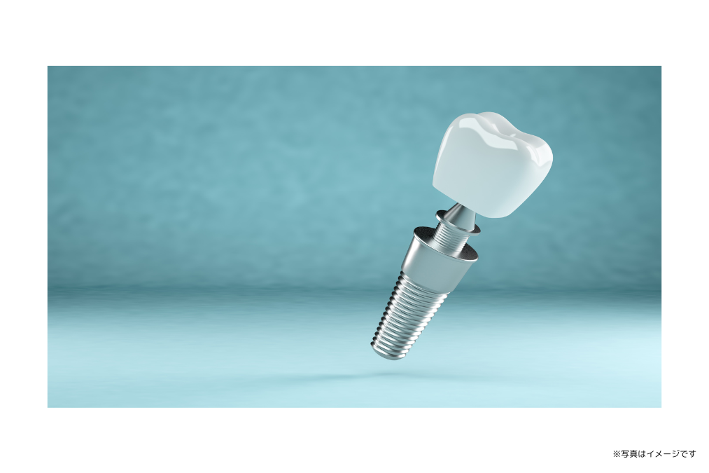 患者様の希望に沿った最適な治療法を提案することを心がけています