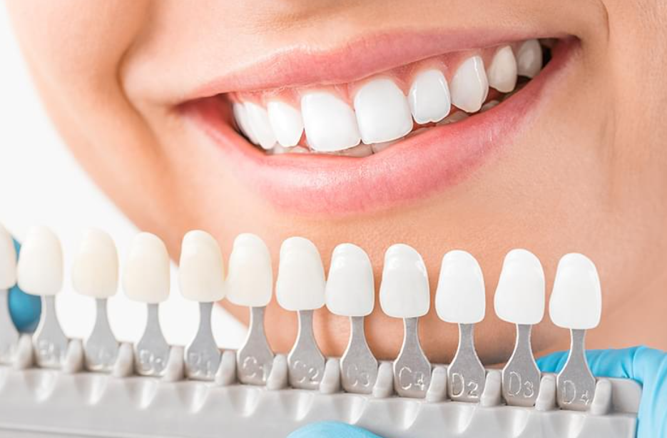 オフィスとホームの二つのアプローチで理想の白さを追求