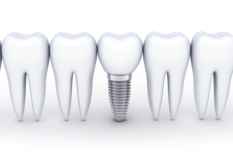 できる限り分かりやすく説明いたします
