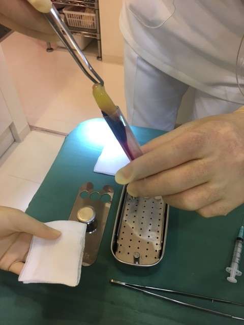 再生治療は患者様自身から再生成長因子を生成する為、より安全です