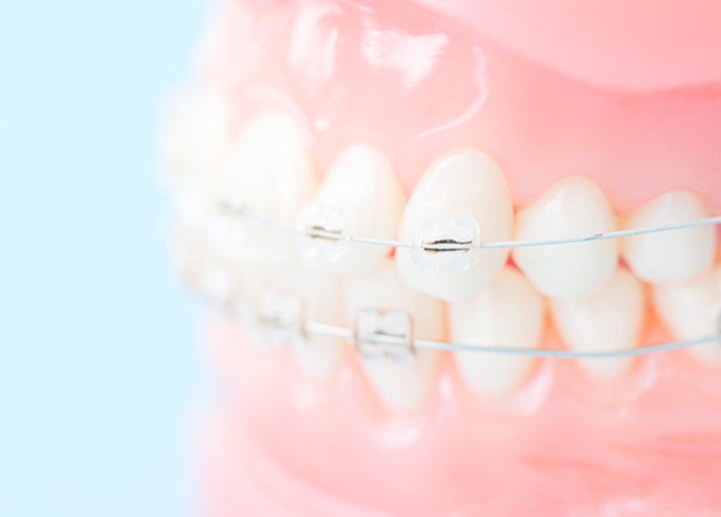 子どもから大人まで対応する患者に優しい矯正治療の提供