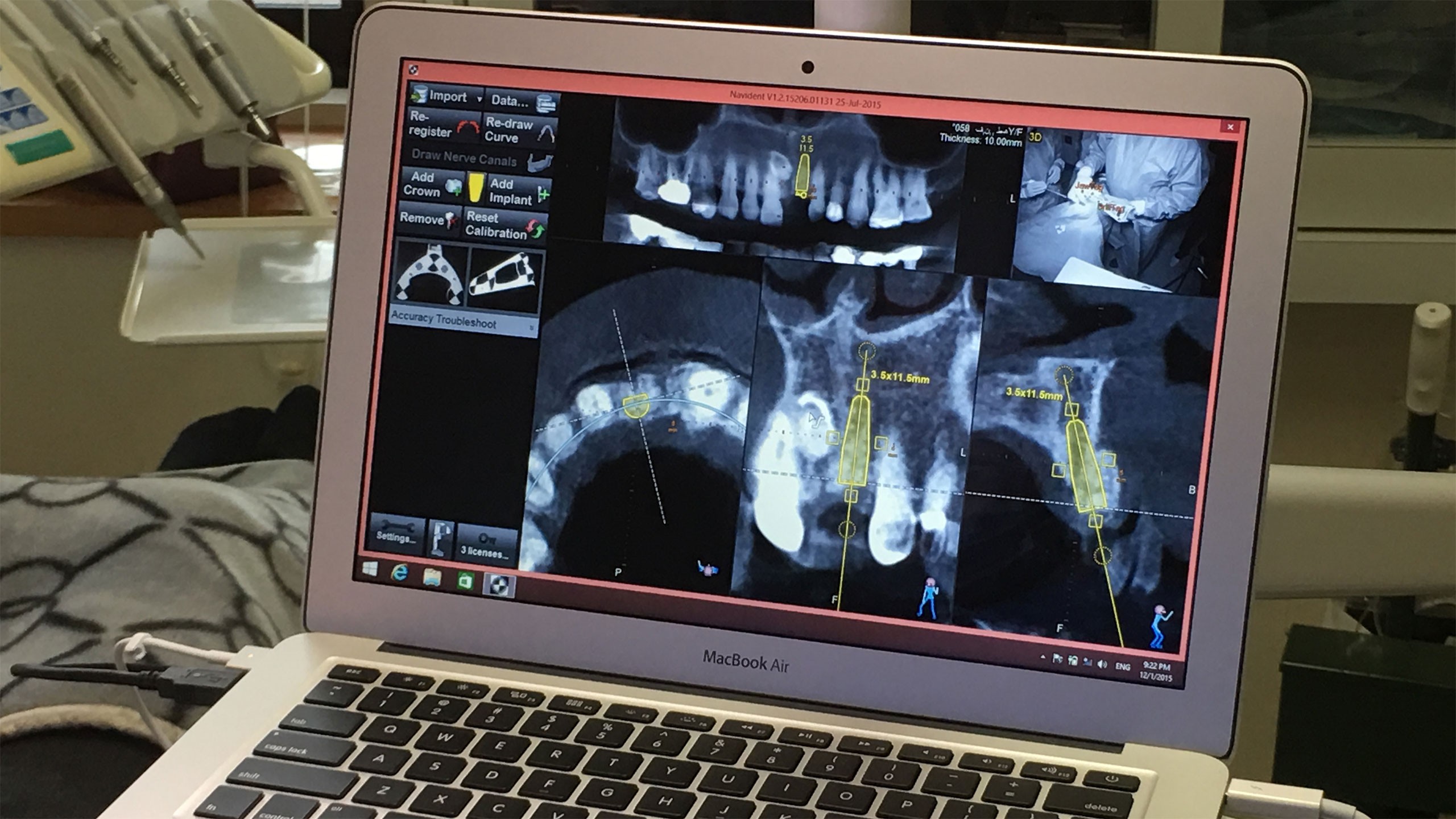 経験と診査を重ねた安全重視の治療
