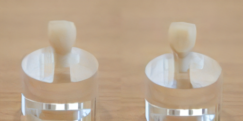 技術を重ねる審美歯科