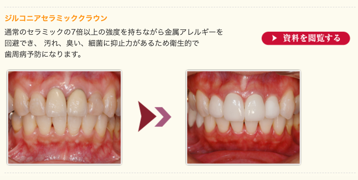 見た目の美しさだけでなく、患者様の口元全体の調和を大切にした施術を心がけています
