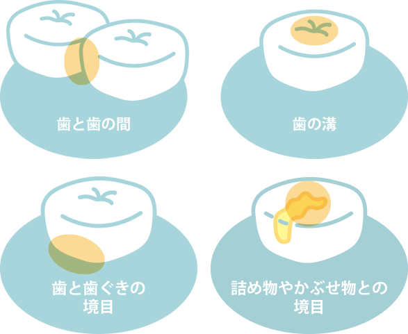 予防歯科-お口の健康を維持しましょう。