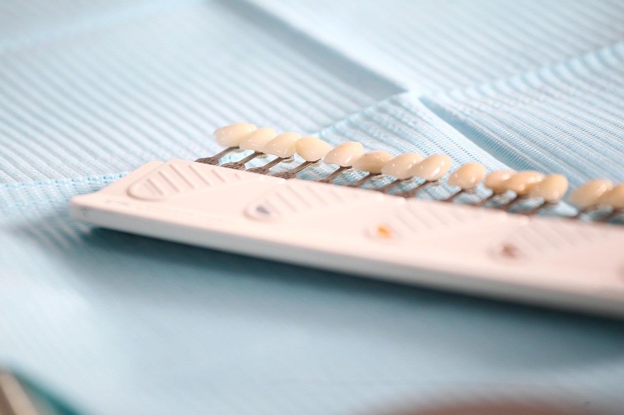 歯の色が整うことで、笑顔に自信を持ちやすくなり、第一印象の向上にもつながります。※写真はイメージです。