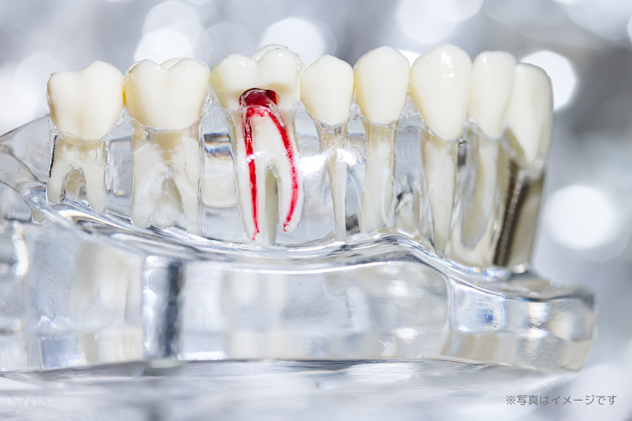 精密な根管治療（マイクロエンド）を行い、歯の保存を目指しています