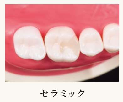 浅いむし歯の治療もお任せください