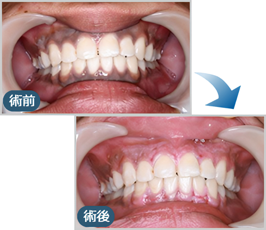 笑顔に自信を持ちたい方は、ぜひ一度ご相談ください
