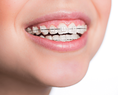 正しい噛み合わせで健康な口腔環境