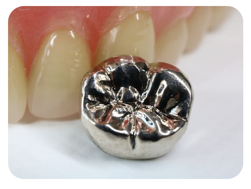 金属アレルギーや口腔粘膜疾患に関する治療も行っております