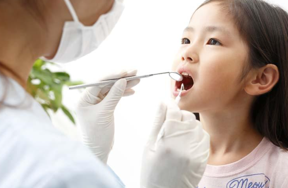 フッ素応用とシーラント処置で将来まで続く健康な歯を育成