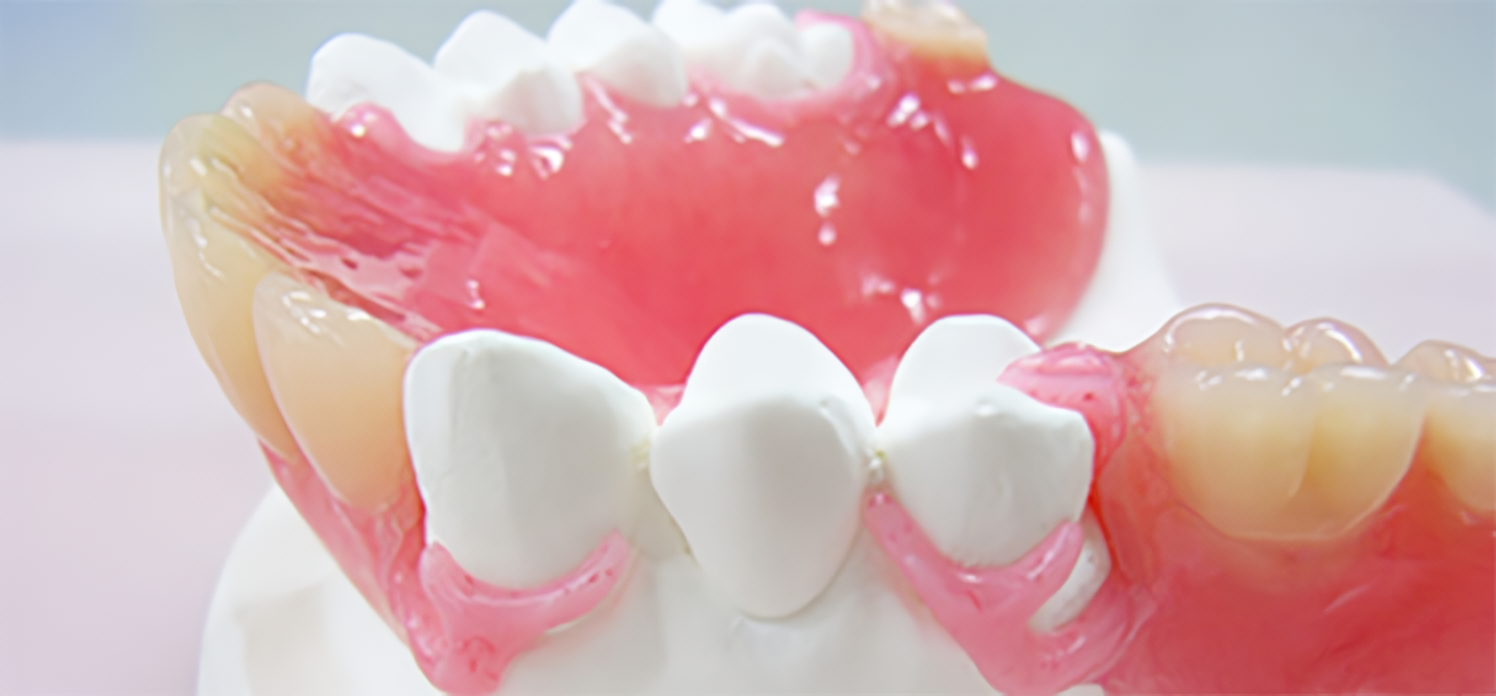 入れ歯で食事も会話ももっと楽しく