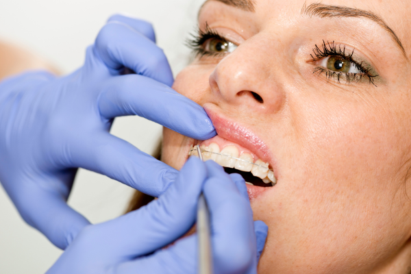 ※画像はイメージです