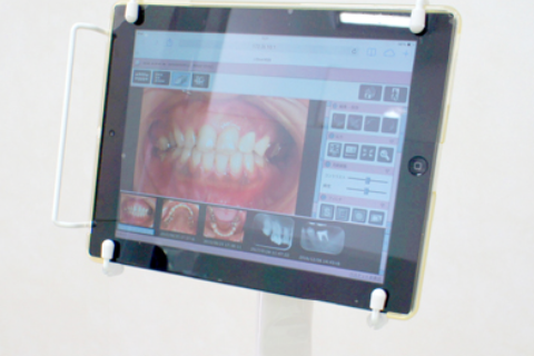 歯周病は早めの対策が必要です