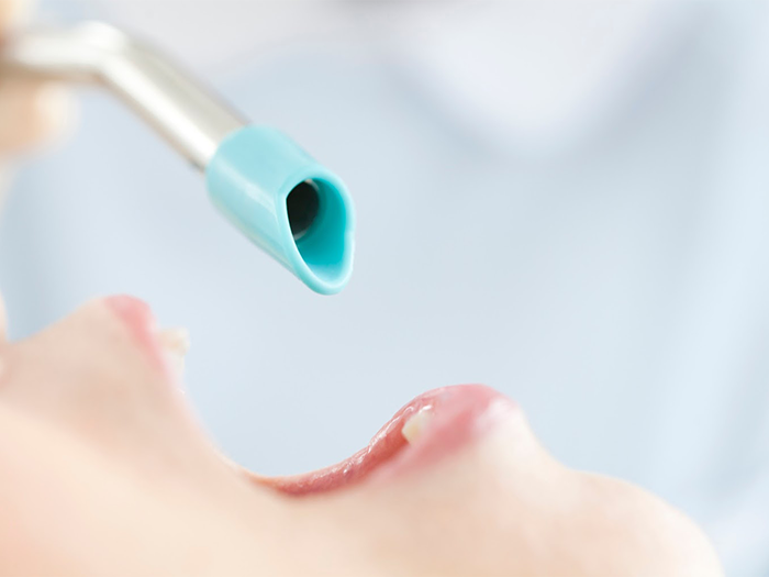 痛みや腫れを抑えた親知らずの抜歯に対応しています