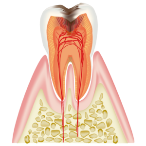 歯内療法とは根管治療のことです