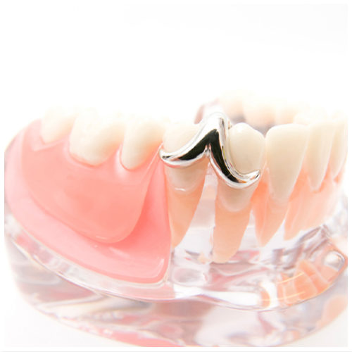 入れ歯やインプラント治療は自由診療となります。