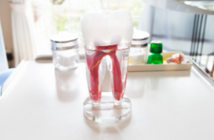 早期発見・適切なケアで歯を守る