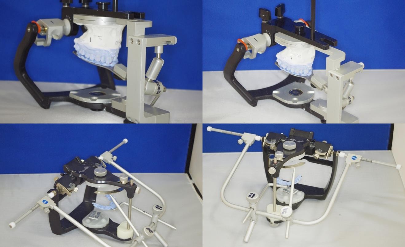 被せ物を製作する際に正確な再現を行っています