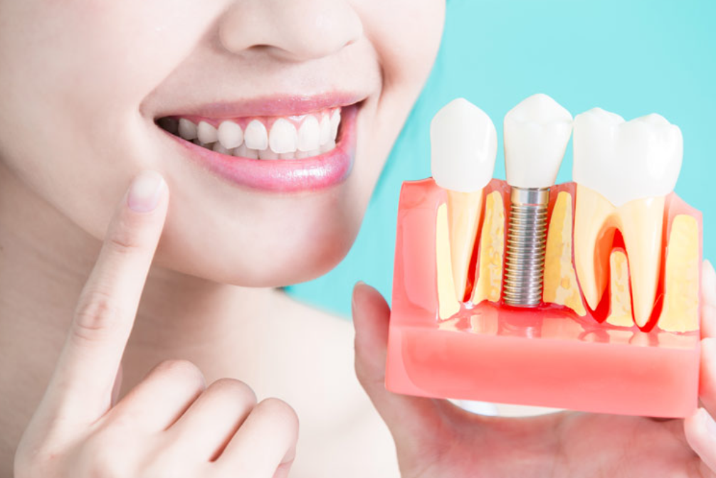 グループ3医院で10,000症例の実績と先進技術による安心のインプラント治療