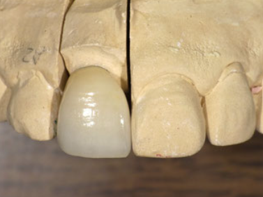 口元が美しくなると、笑顔に自信が持てます