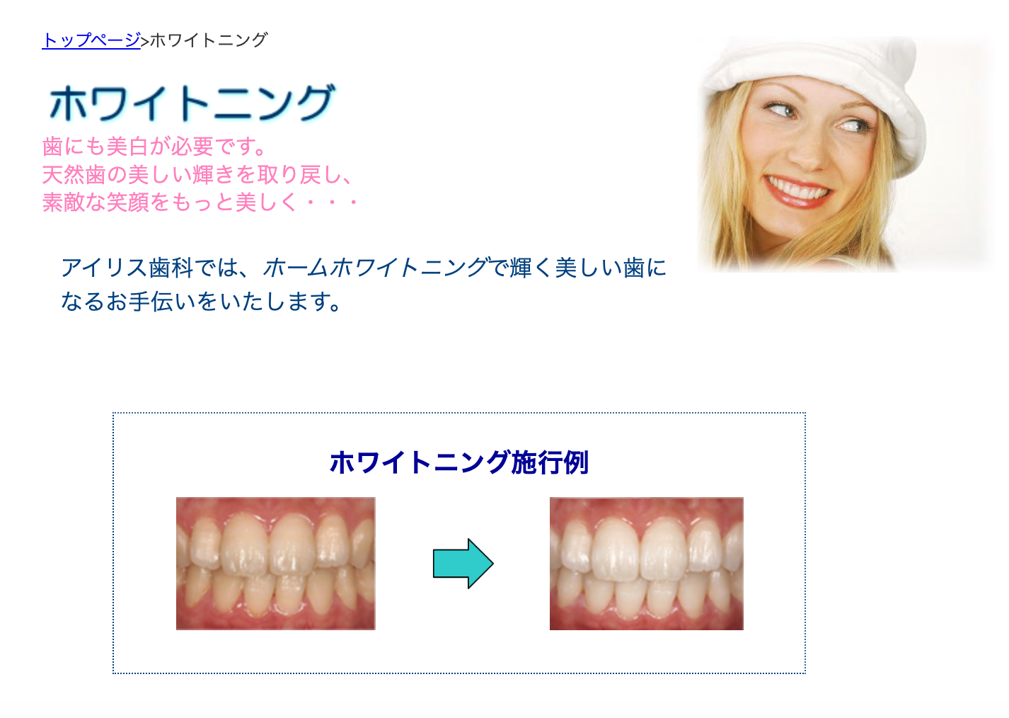 患者様ご自身で自宅で行えるホームホワイトニングを提供しています