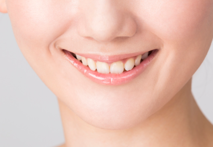 患者様の笑顔を引き出す審美歯科ケア