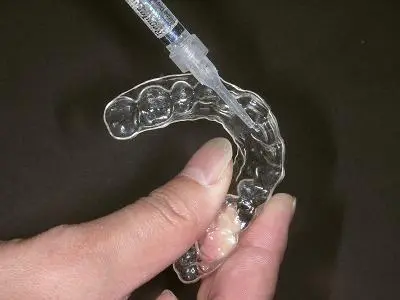 清潔感と若々しさを引き出すホワイトニングメニューを用意