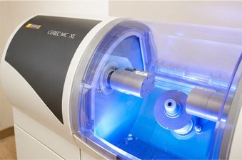 セレック完備