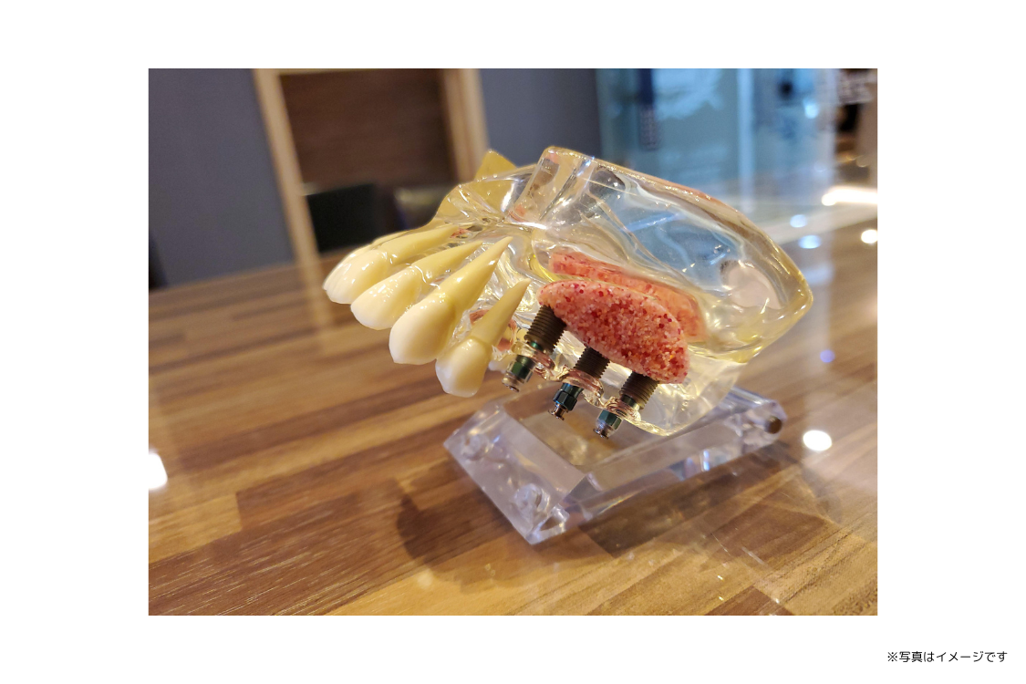 丁寧なカウンセリングにより、治療内容について十分な説明を行います