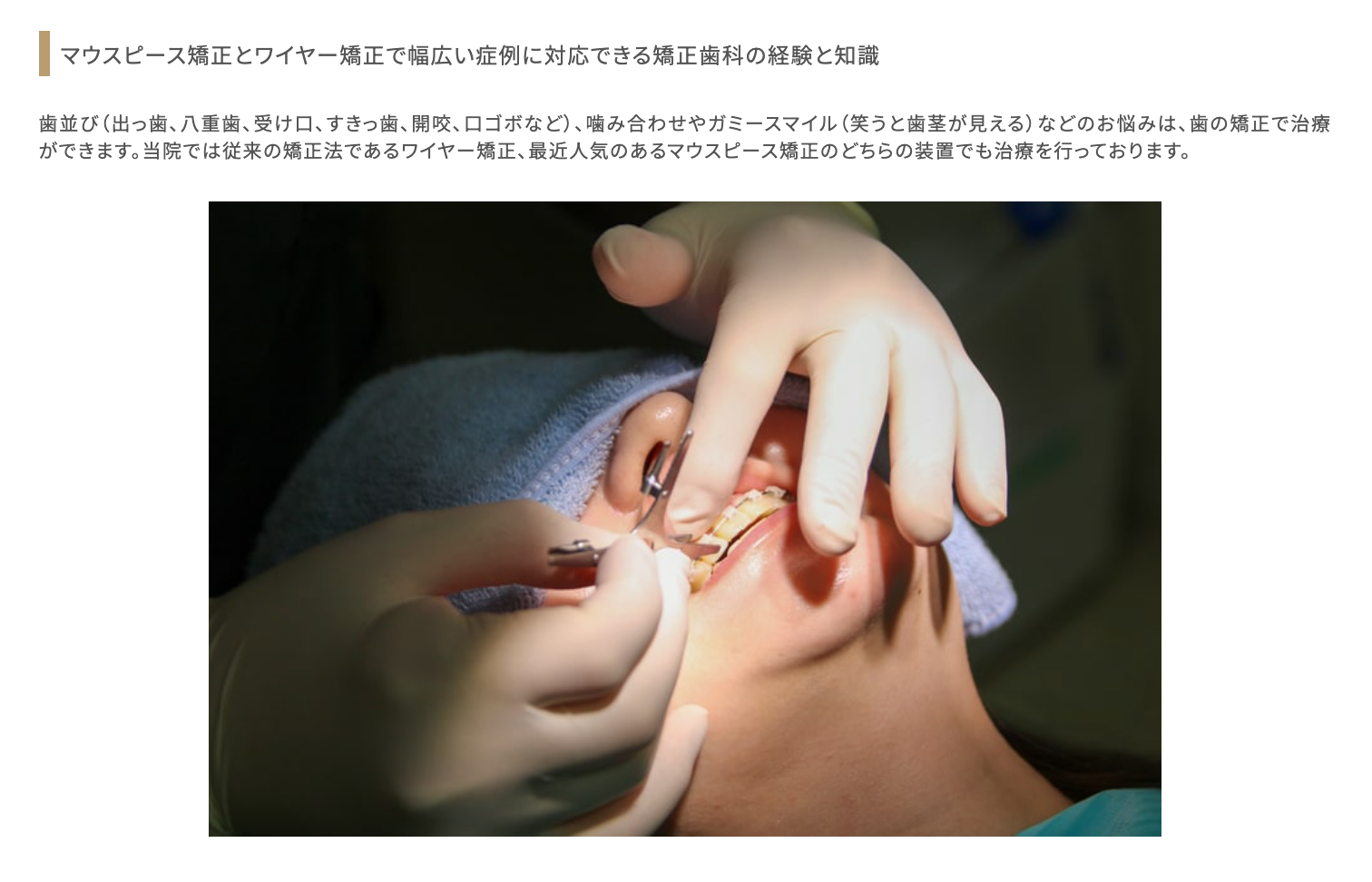 矯正歯科の治療において幅広い症例に対応しています