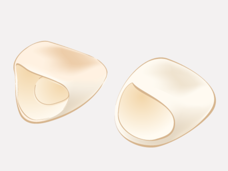 豊富な治療経験と知識により、審美性に優れた治療を提供いたします